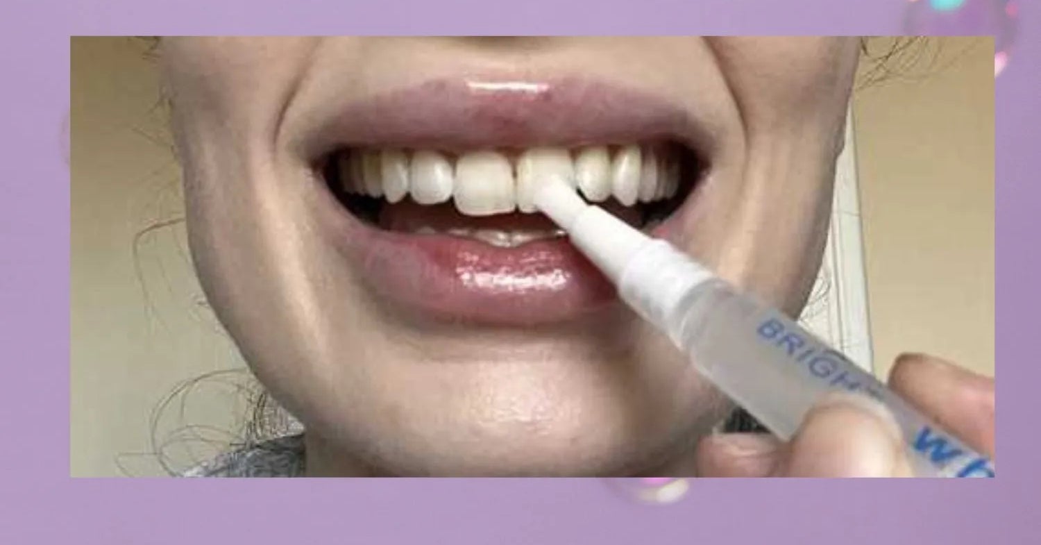 I Was About To Spend $400 On Professional Teeth Whitening Until I Tried This $15 Pen
