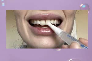 A person using a teeth whitening pen on their teeth, shown smiling. Bubbles float around the image's purple background