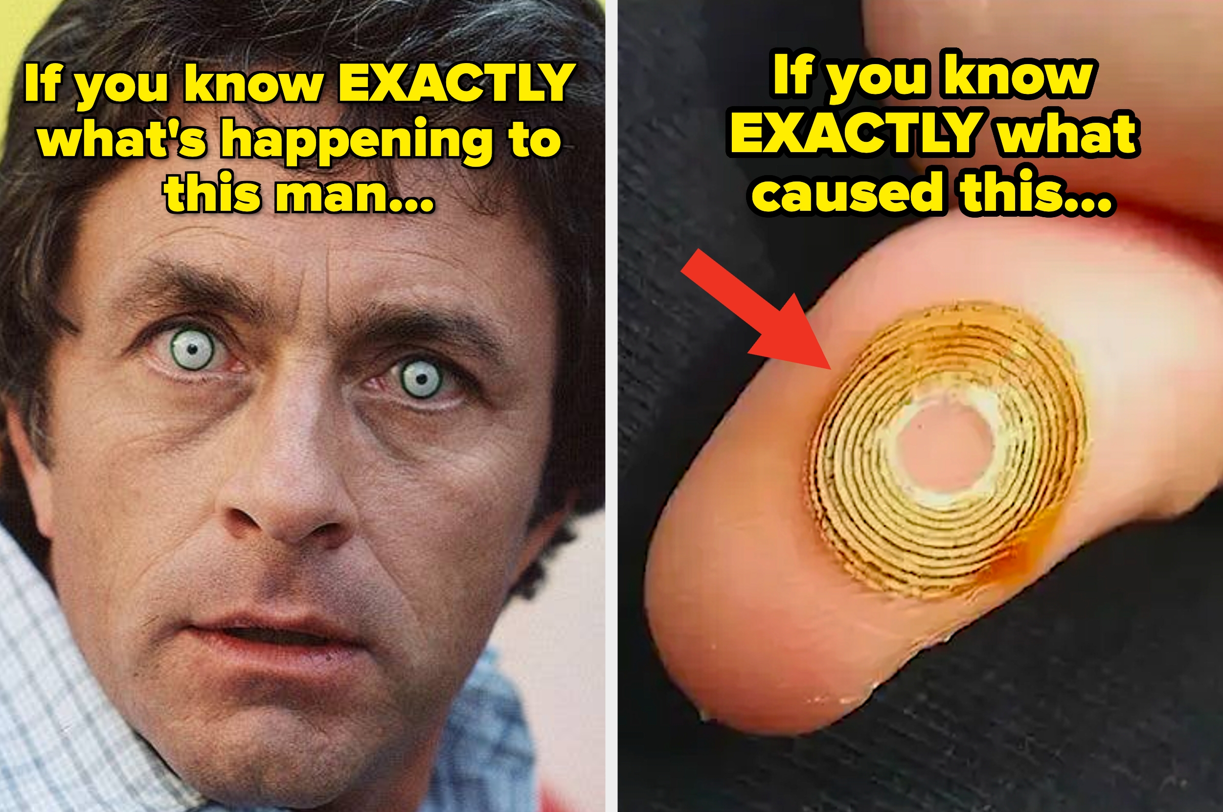 Split image with text: Left - close-up of a man's face with glazed eyes and shocked expression. Right - close-up of a fingerprint burn scar on a fingertip