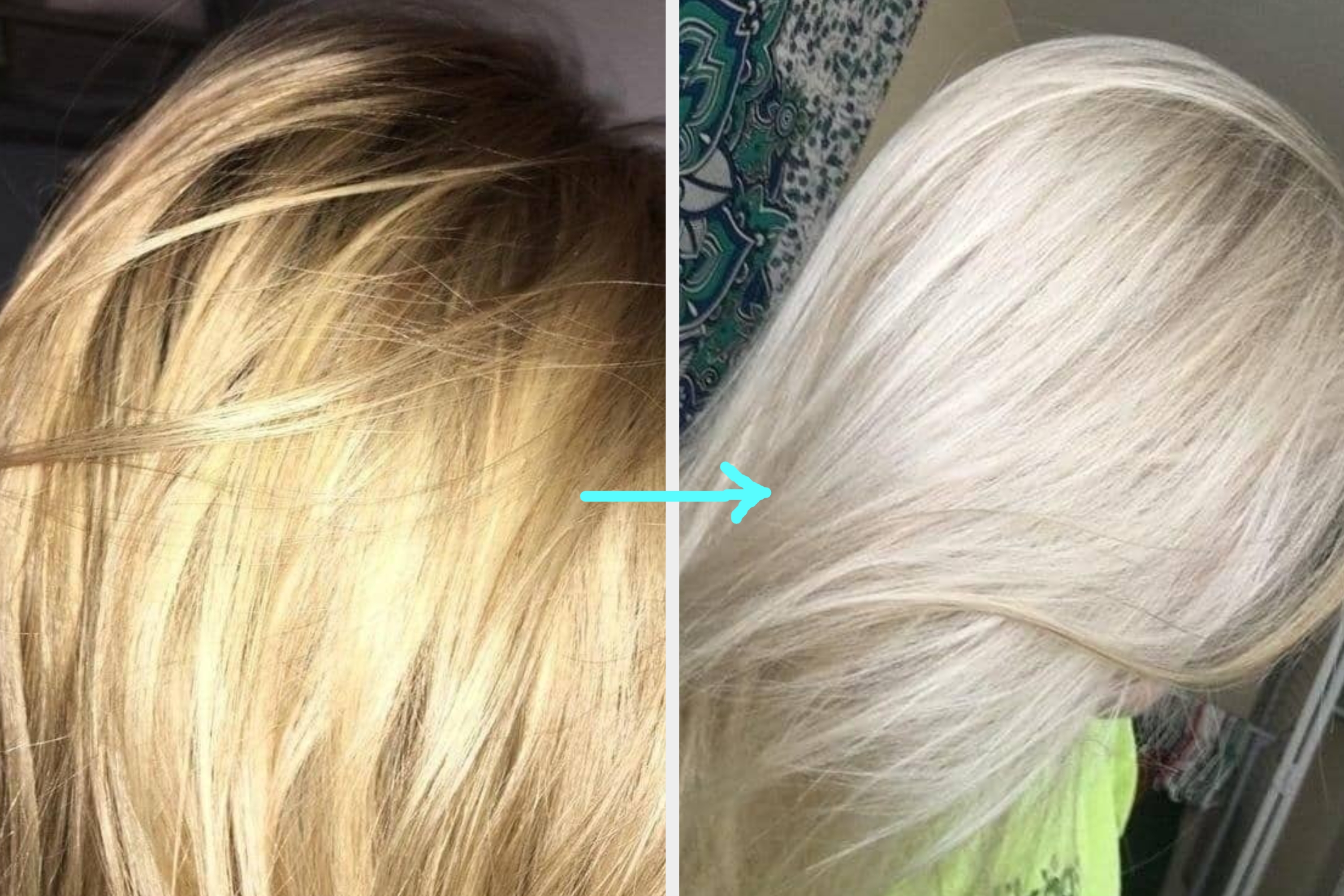 Person with curly hair smiles; adjacent image shows a skincare transformation with clearer skin, emphasizing a product's effectiveness