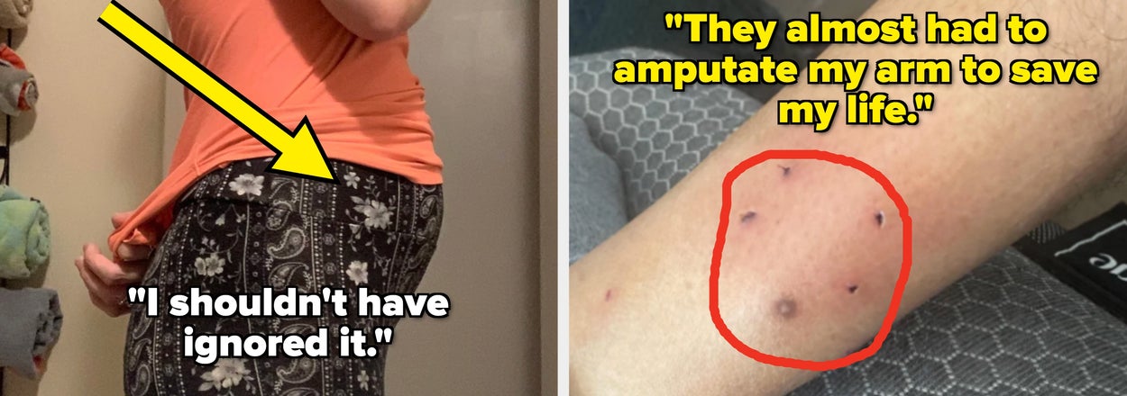 "I Should’ve Gone To The Doctor Sooner": People Are Sharing The Early Health Warning Signs They Regret Ignoring