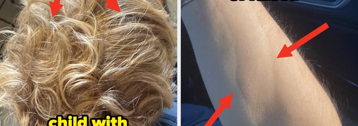 20 Jaw-Dropping Pictures Of The Human Body That Will Completely And Totally Change Your Perspective On Life
