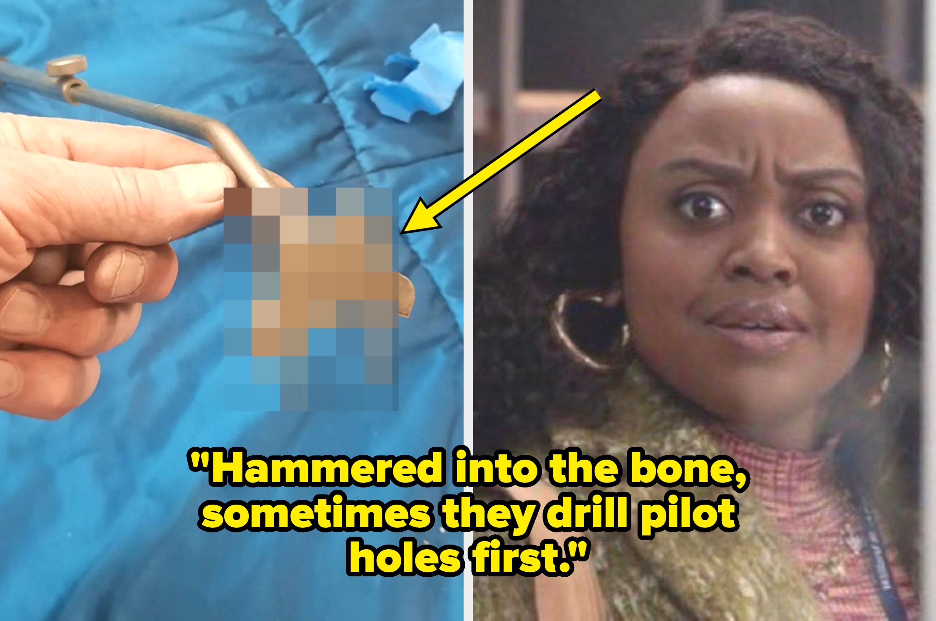 Close-up of surgical tool and startled woman. Text: "Hammered into the bone, sometimes they drill pilot holes first."