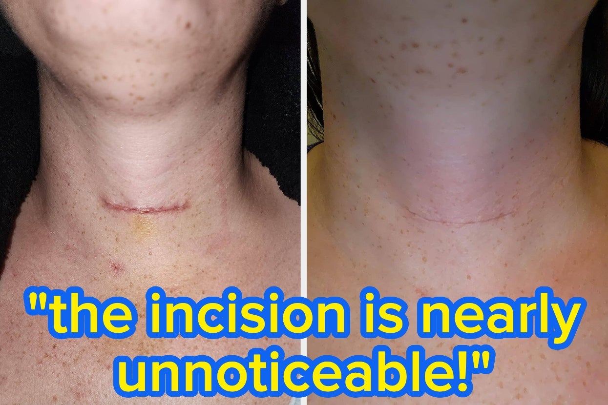 Just 36 Popular Skincare Products That Won’t Cost An Arm And A Leg