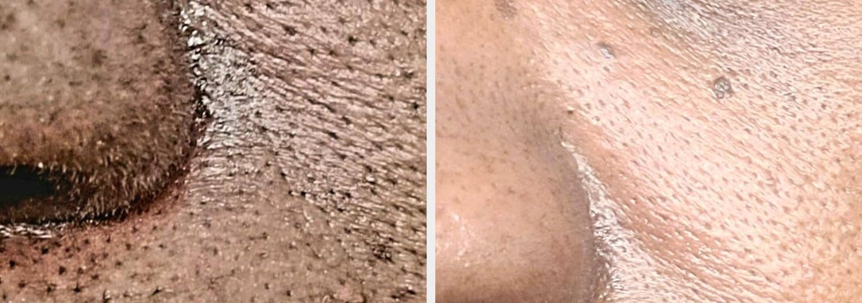 If 2026 Is The Year You Stop Spending So Much On Beauty Products, Check Out These 34 Excellent Options Under $20