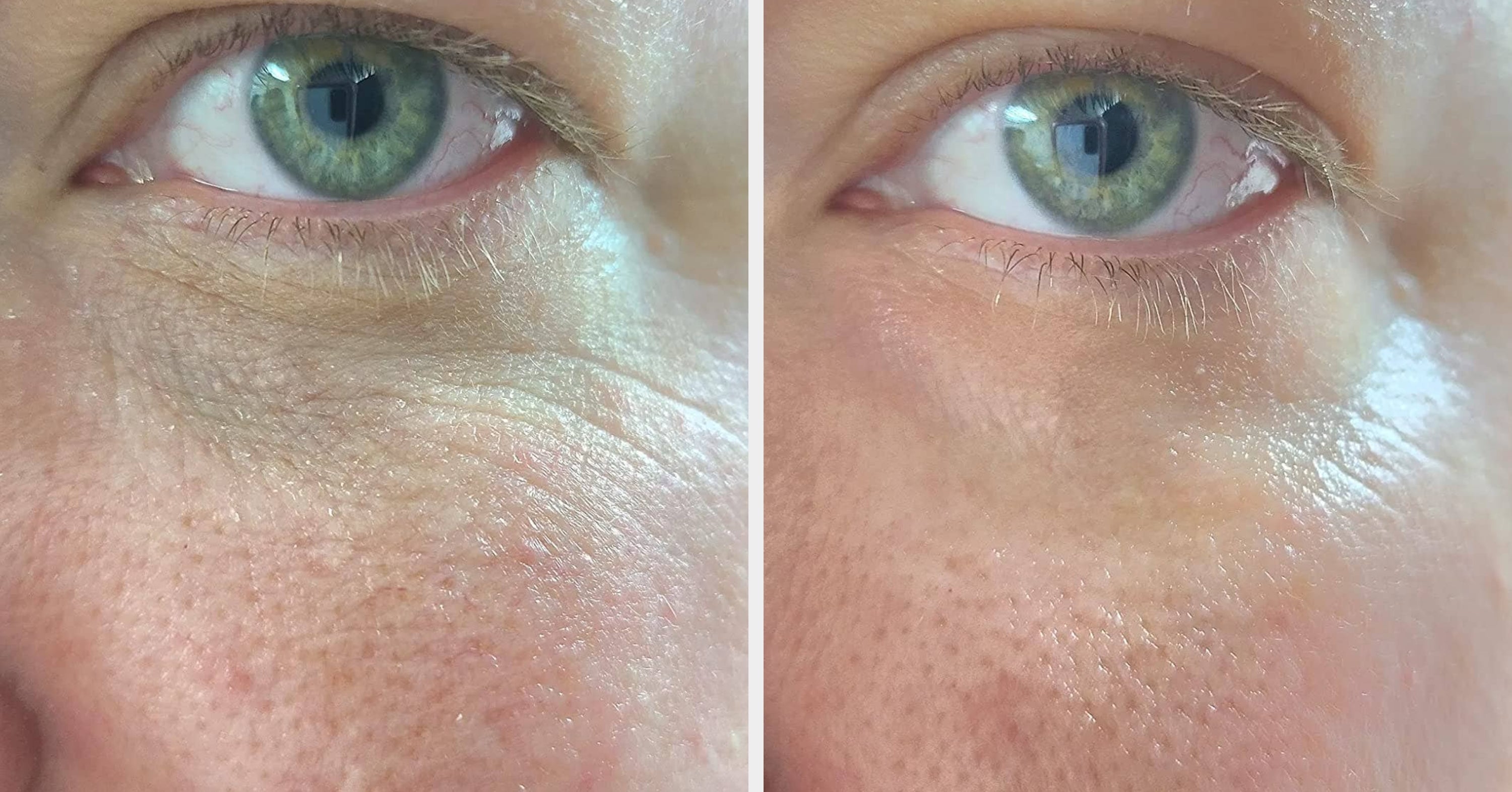 It’s Not Too Late To Join The Bandwagon On These 33 Super Popular Beauty Products — They’re *That* Good