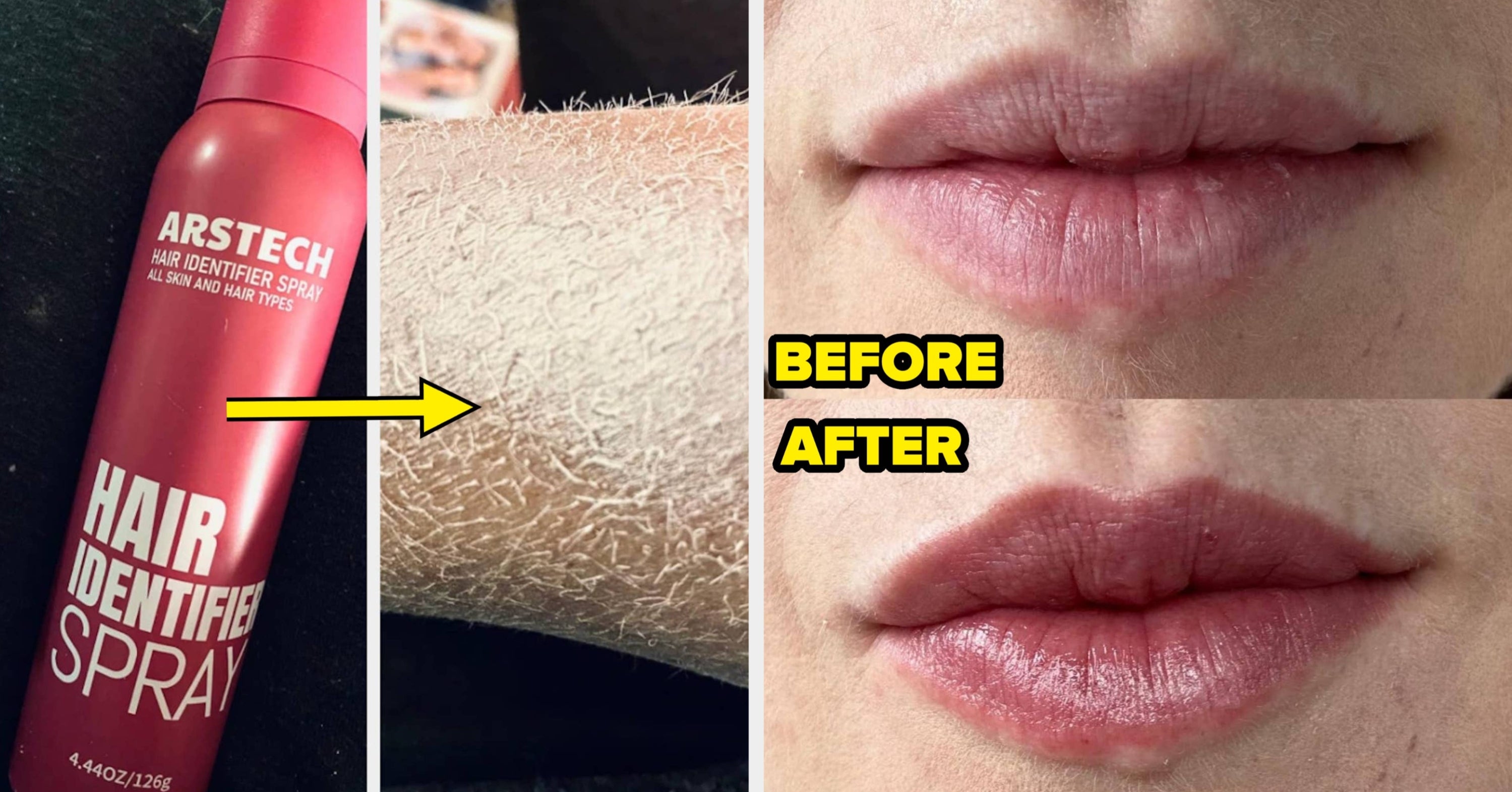 34 Beauty Products With Befores And Afters So Good, You’ll Be Like, “Me Next”