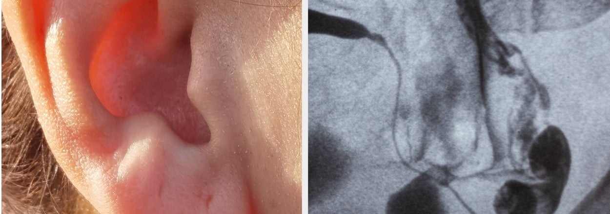 22 Medical Facts That Sound Fake But Are 100% True