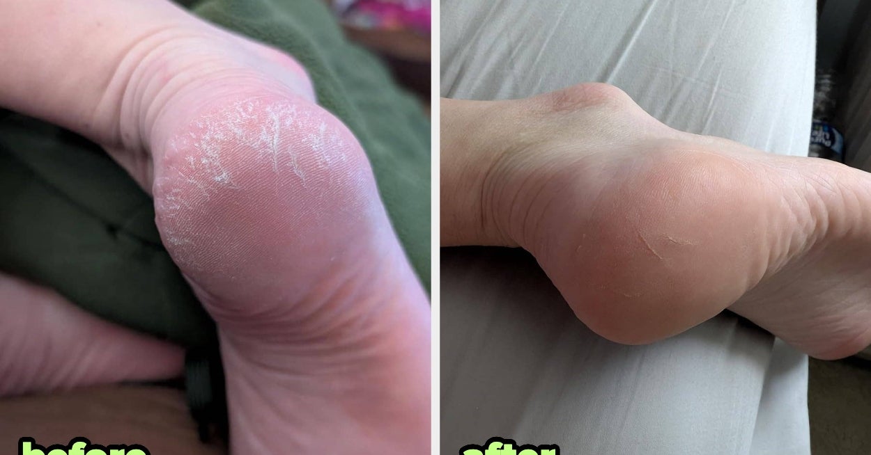 If Your Hair, Skin, And Nails Are Feeling Parched, You Probably Need These 27 Beauty Products