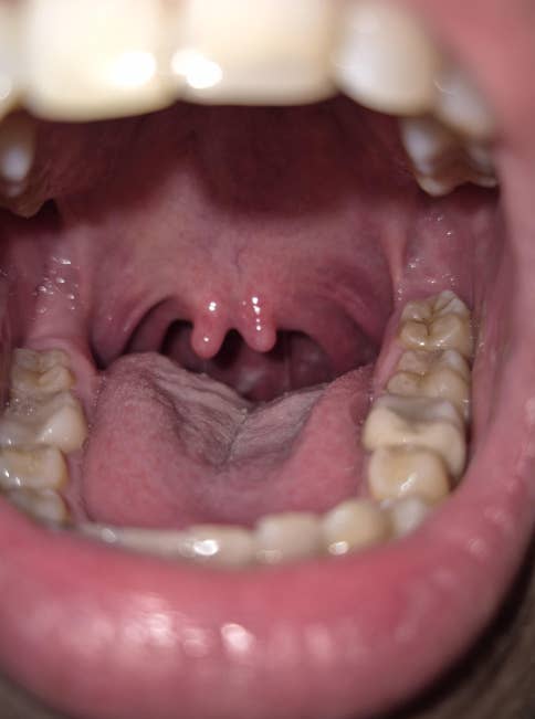 Close-up of an unfastened  rima  showing teeth and uvula