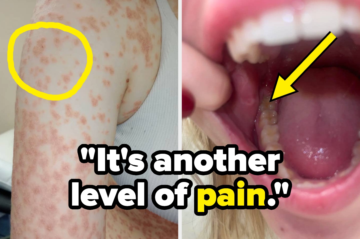 21 Medical Issues That People Think Are "Minor" But Are Actually "Agonizing" To Live With