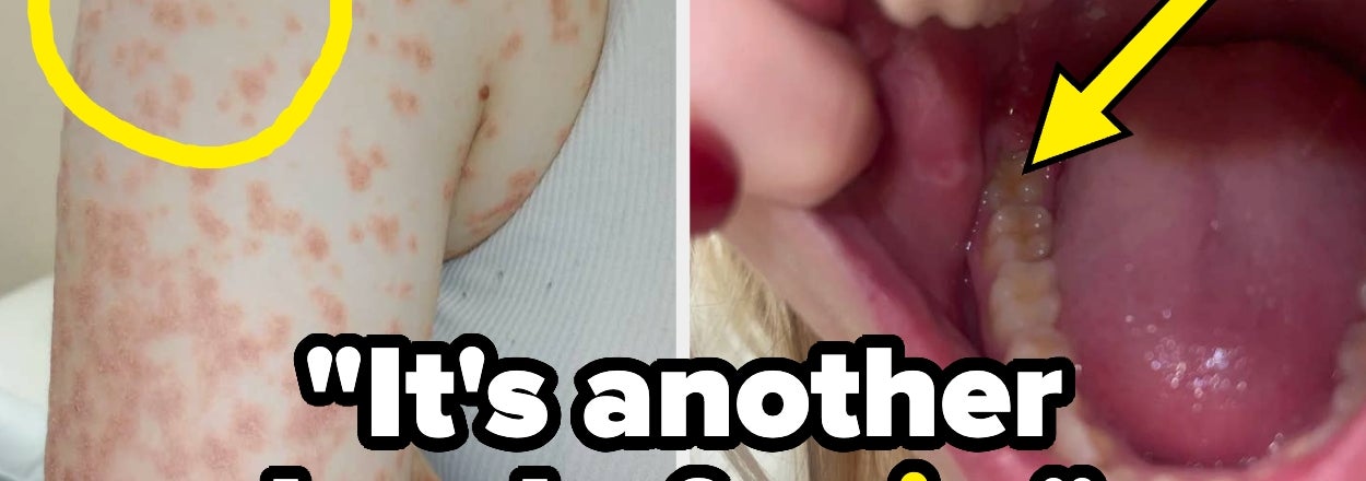 People Are Sharing The Seemingly "Minor" Medical Issues That Majorly Affect Their Lives, And Some Of These Are Surprising