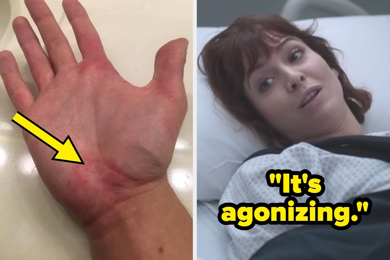 21 Medical Issues That People Think Are "Minor" But Are Actually "Agonizing" To Live With