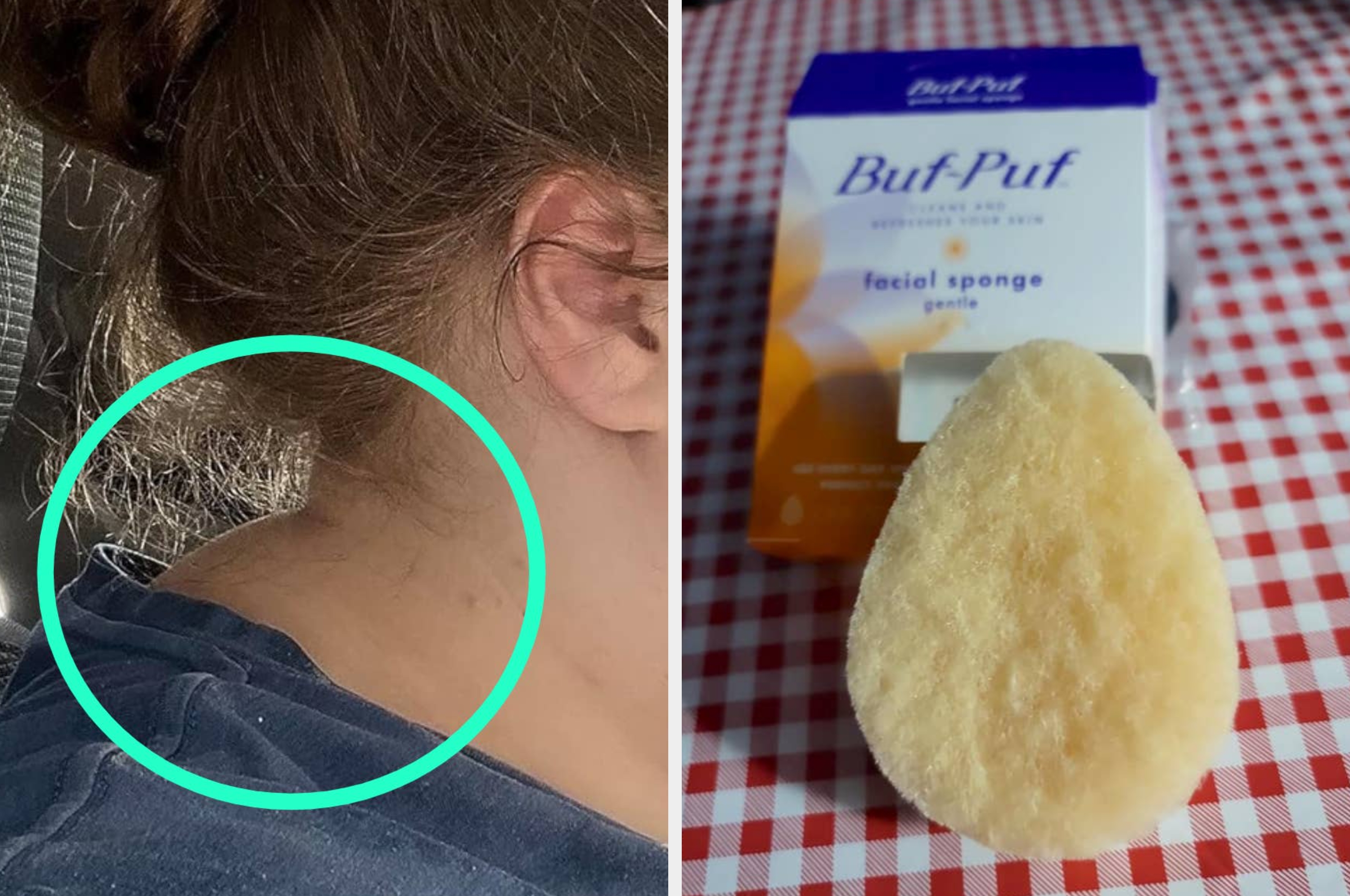 left: back of reviewer's neck with circle around a hump; right: Buf-Puf facial sponge leaning against the packaging