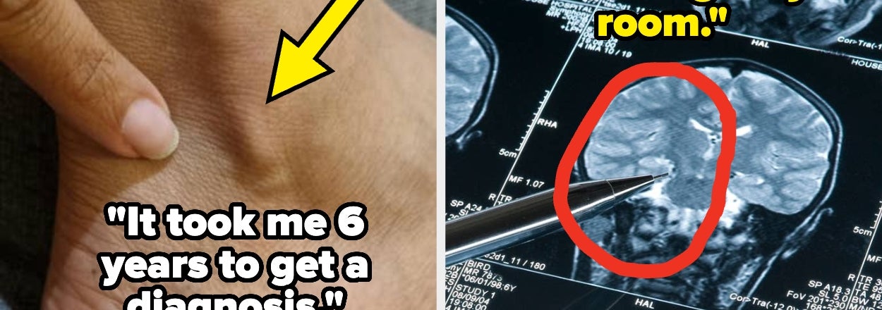"I Was Incredibly Lucky": People Are Sharing The Early Symptoms They Deeply Regret Waiting So Long To Address