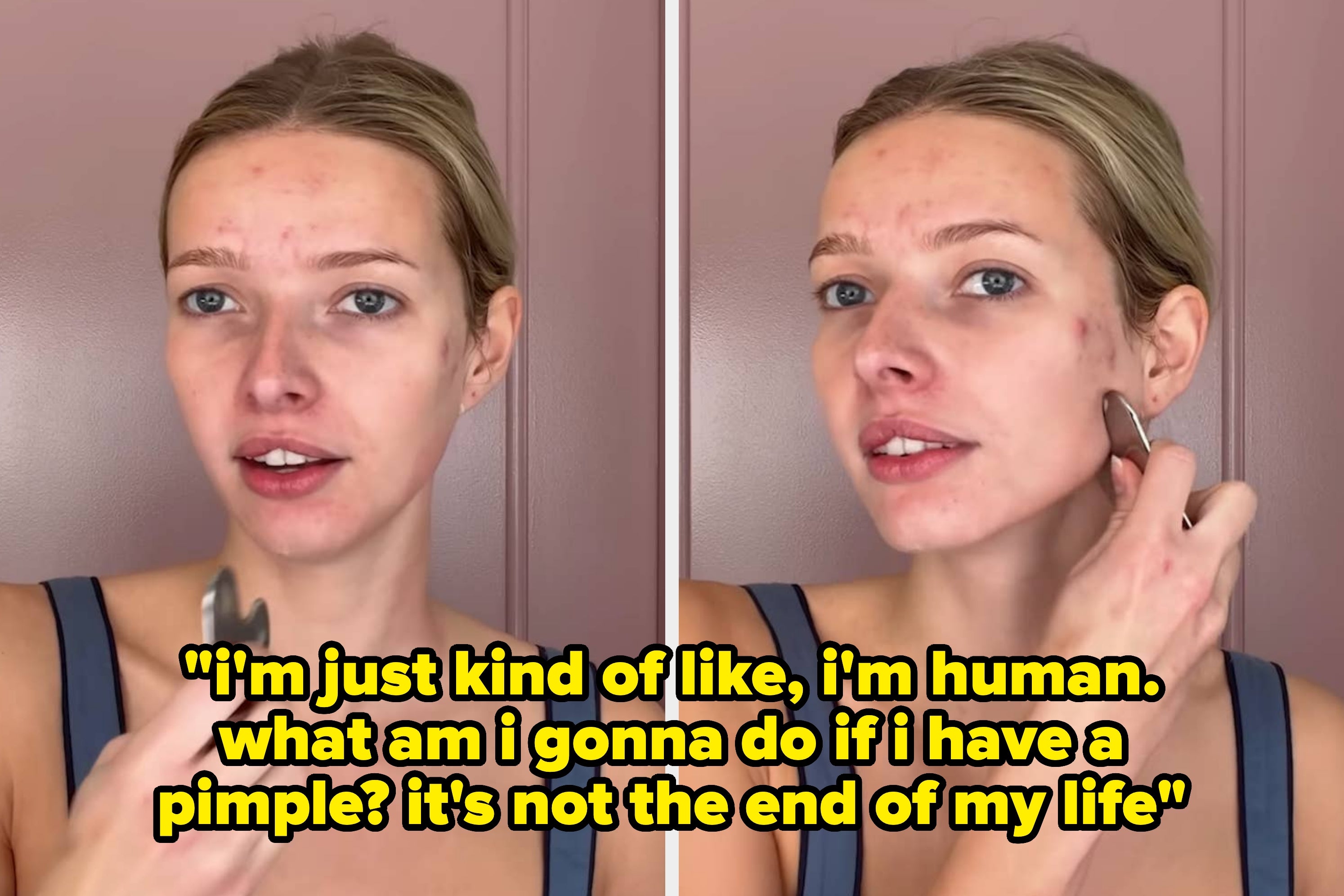 “The Kind Of Content Young Girls Need”: Apple Martin Is Being Praised For Her Refreshing Comments About Her Acne