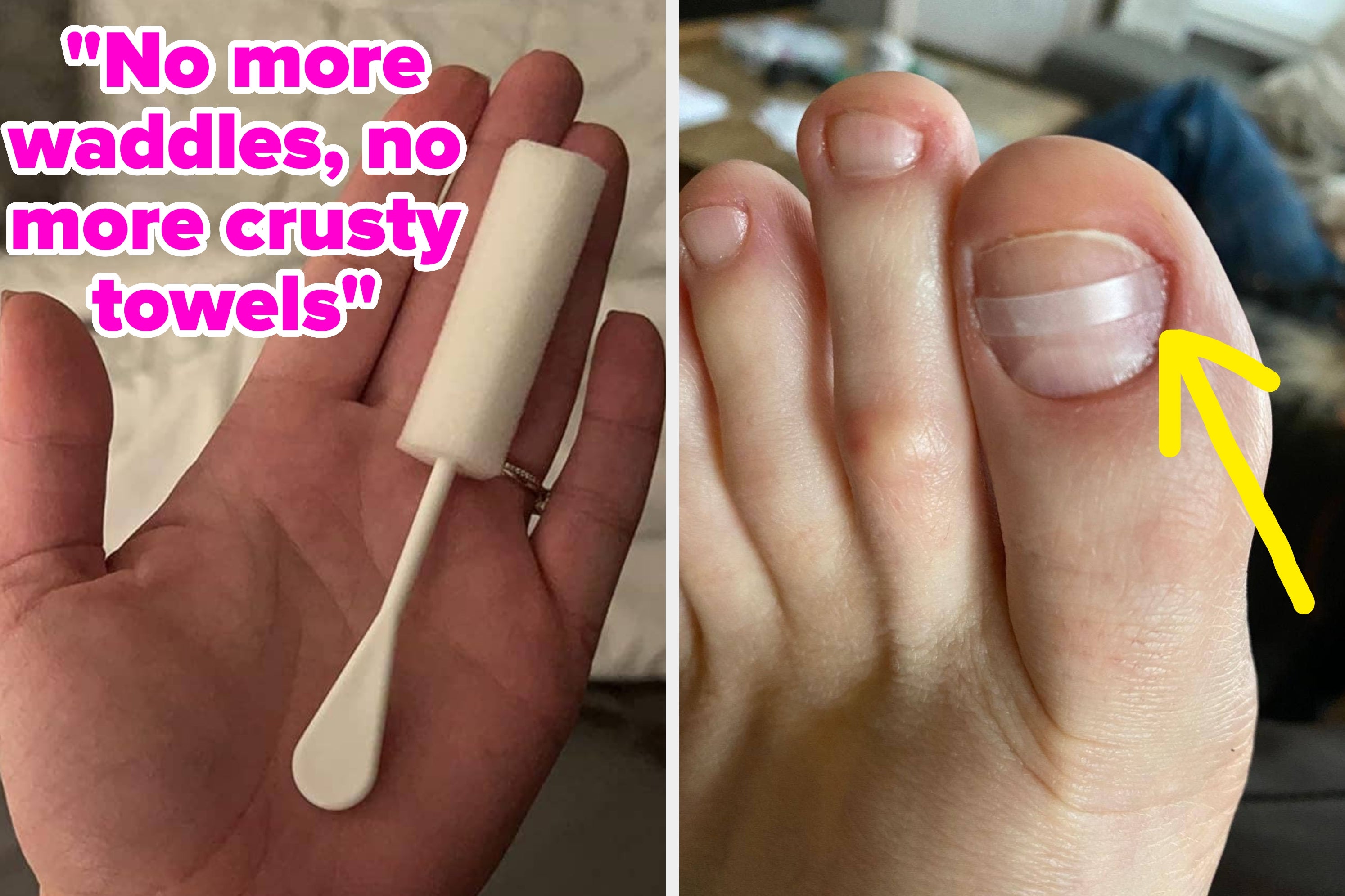 37 Effective Products That Should Be On Your Radar If You’ve Got Annoying Body Problems