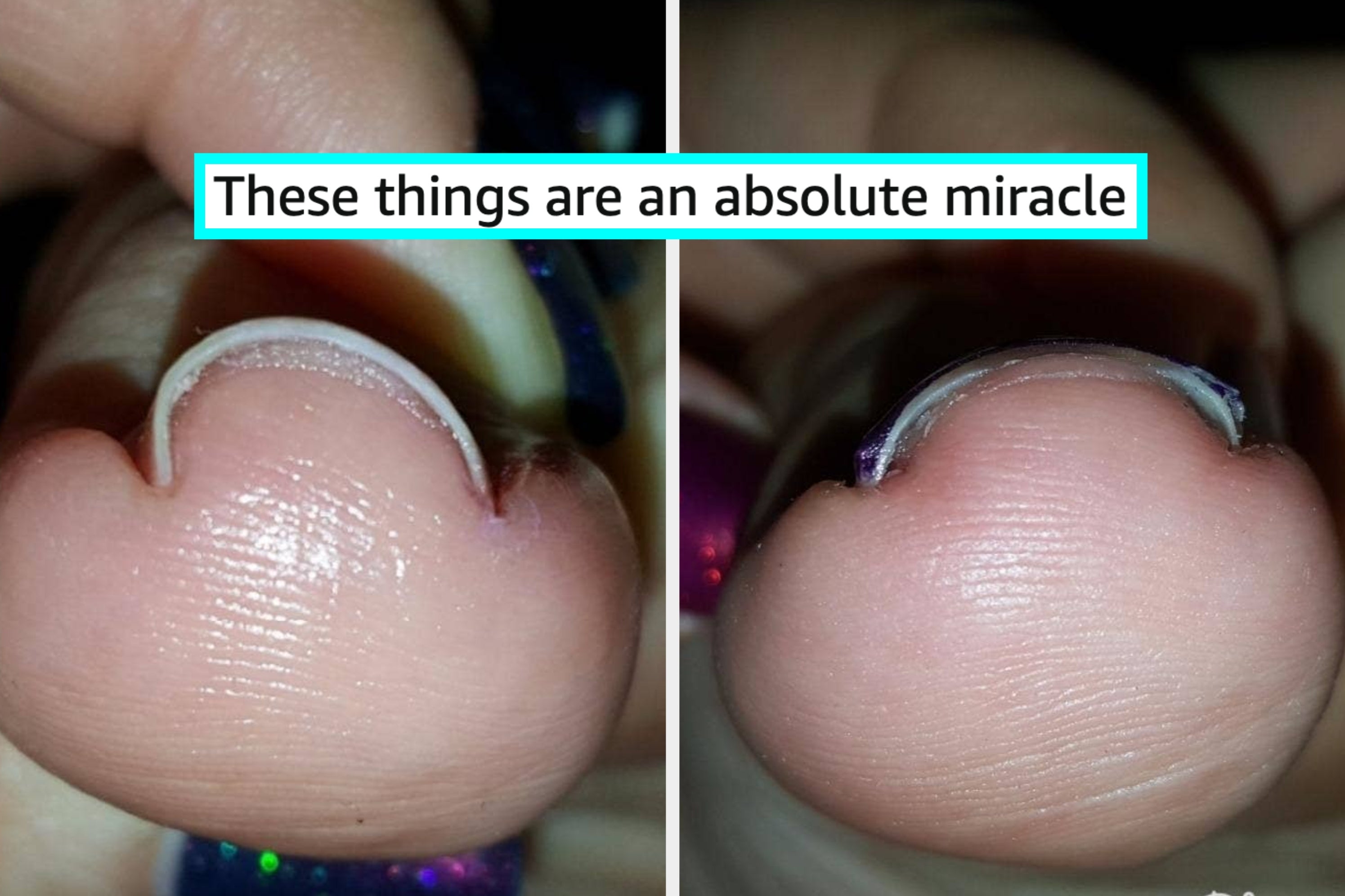 If You’re Truly At Your Limit With Those Annoying Body Problems, Allow Me To Put These 37 Effective Products On Your Radar