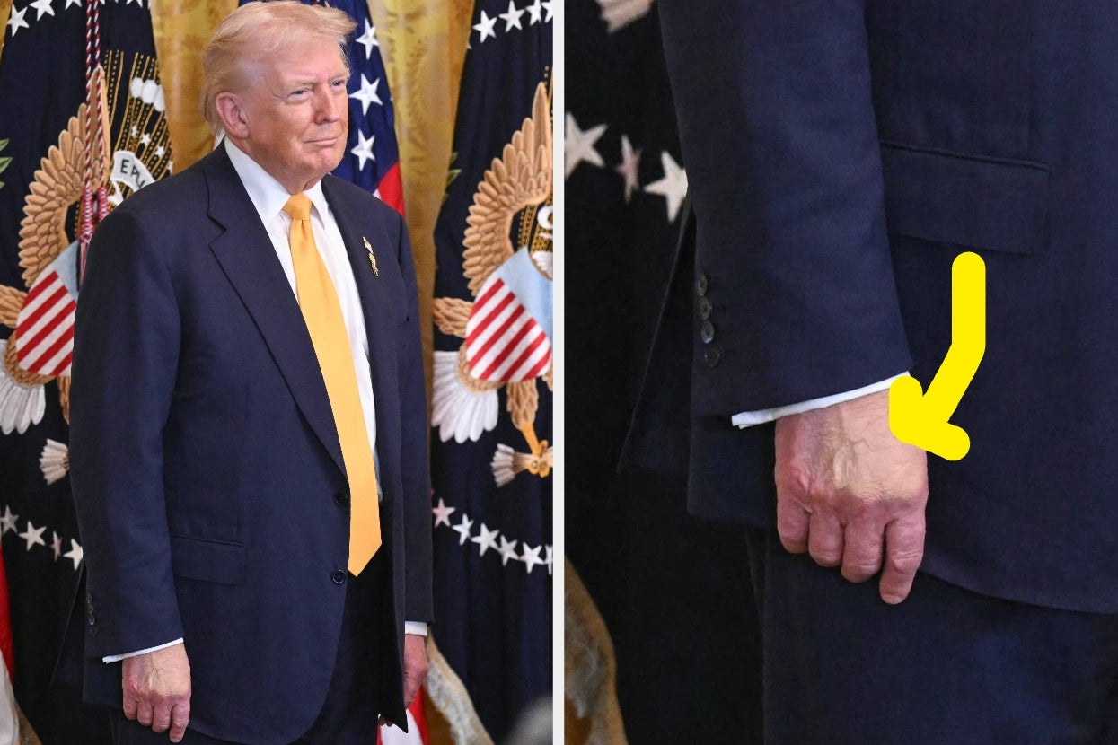 Well, Trump's Hand Looks Suuuuper Discolored In This New Photo