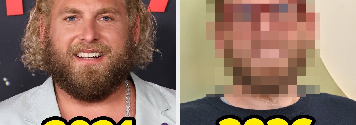 These 13 Celebs Took Major Breaks From The Public Eye, And The Difference In Some Of These Before And After Pictures Is Truly Incredible
