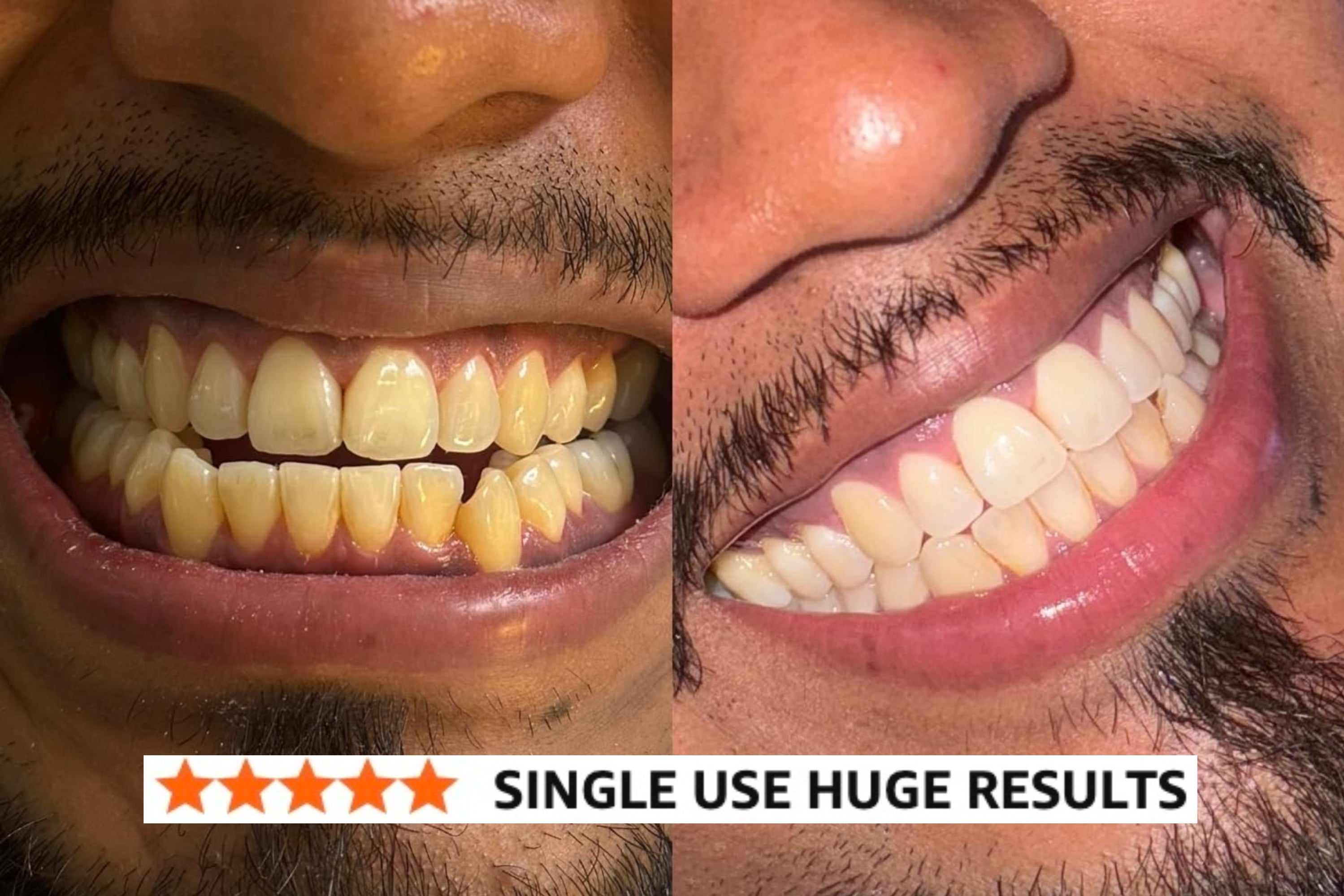 31 Beauty Products With Before And After Pics That’ll Leave You *Flabbergasted*