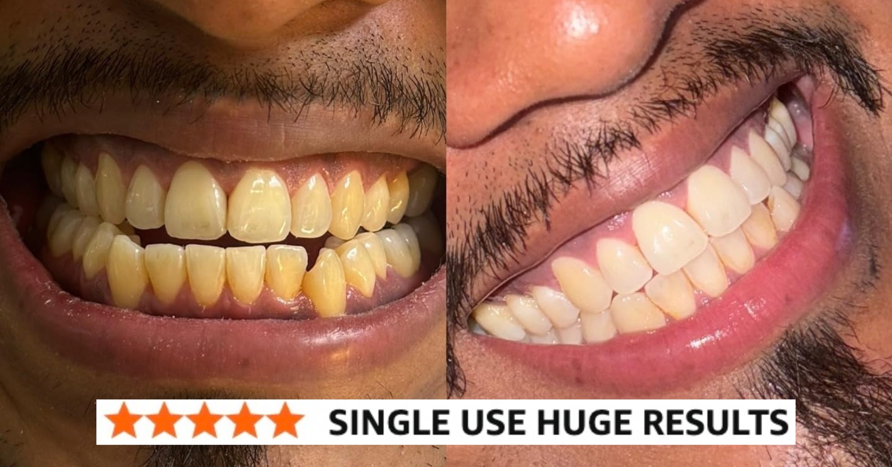 31 Beauty Products With Before And After Pics That’ll Leave You *Flabbergasted*