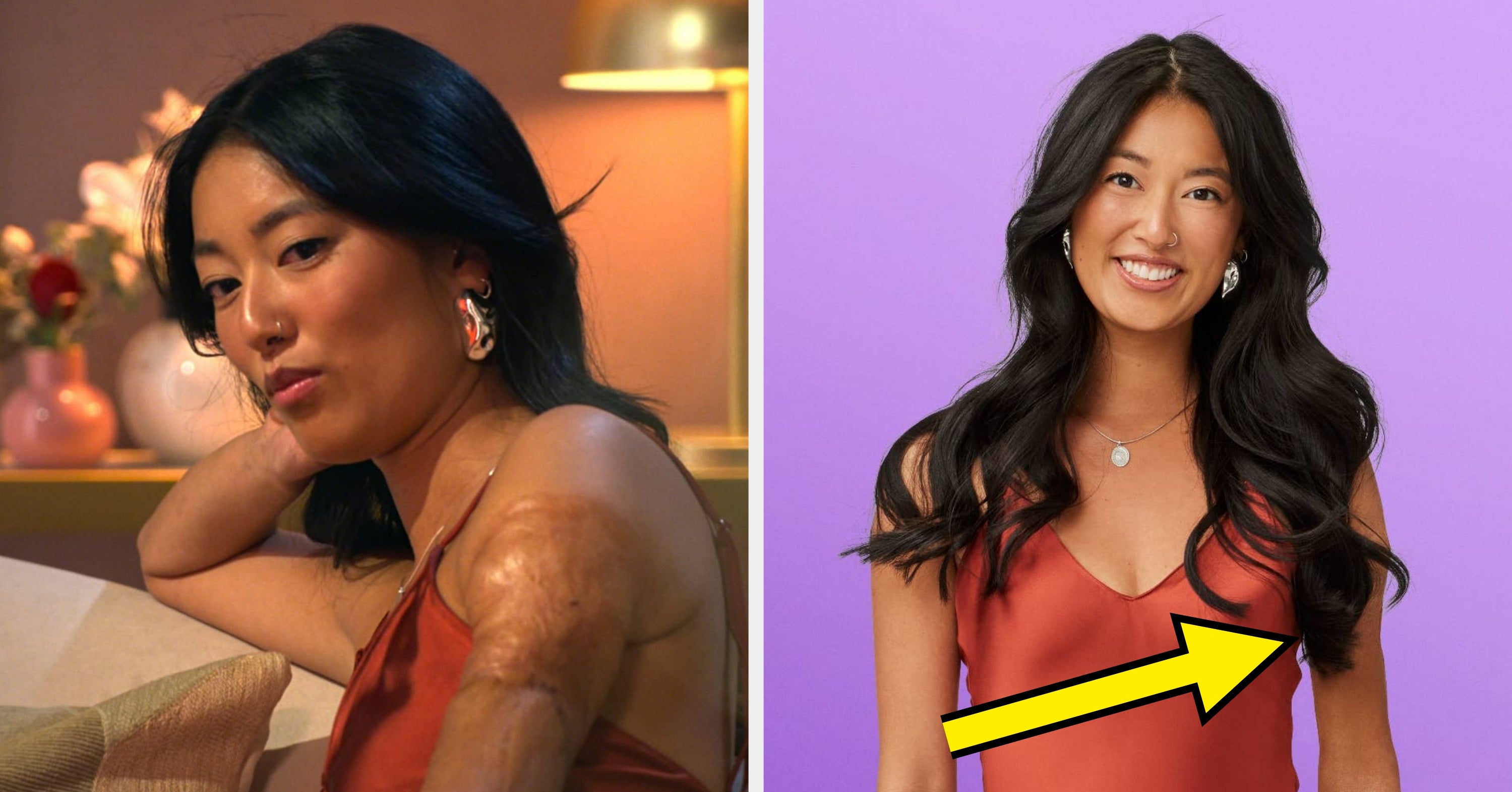 “Love Is Blind” Star Emma Betsinger Has Responded After Netflix Faced Major Backlash For Seemingly Editing Her Scarring Out Of Promotional Photos