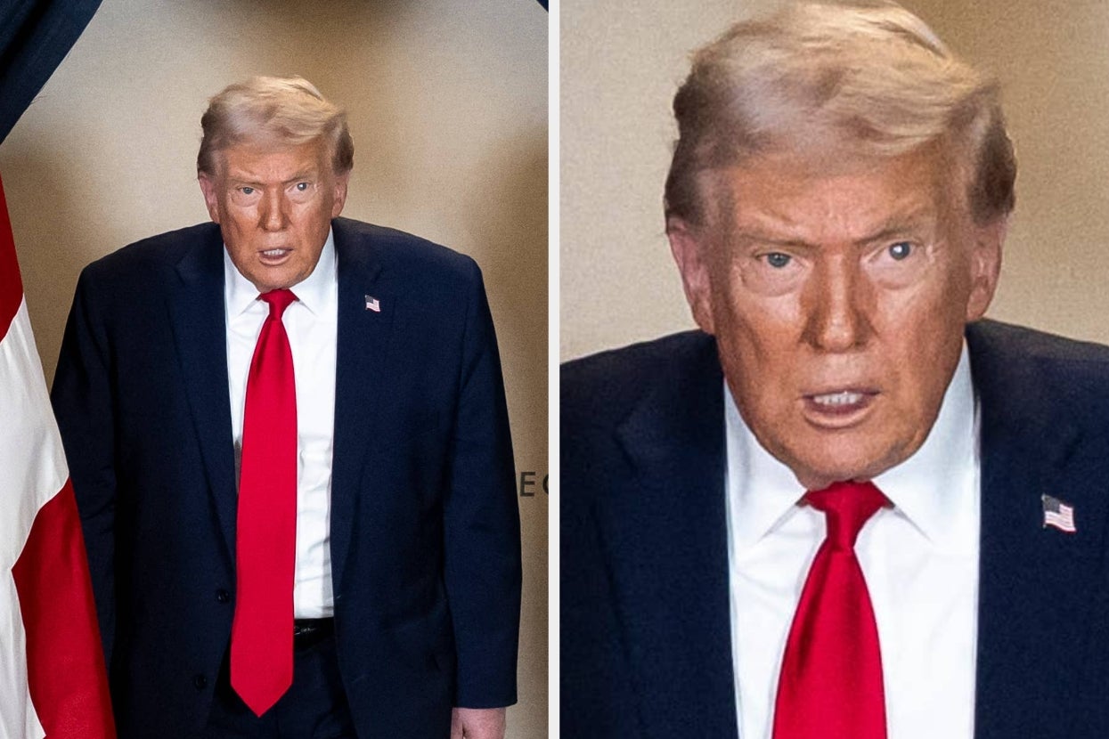 Um, Donald Trump Has A Rash-Like Patch With What Appears To Be Scabbing On His Neck... And The Photo Is Going Viral