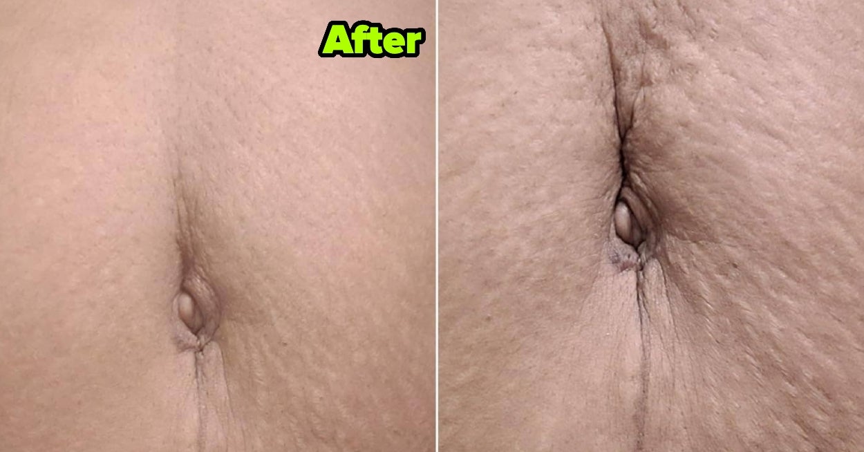 22 Beauty Products With Before And After Photos That’ll Make Your Jaw Drop