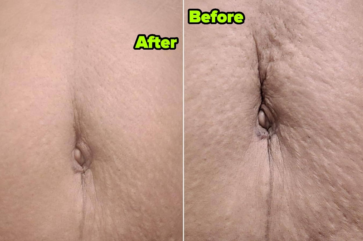 24 Beauty Products With Before And After Photos That’ll Make Your Jaw Drop