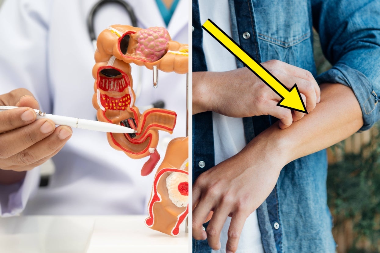 "DON'T STOP TAKING THEM!!!!": People Are Sharing The Body Warnings That Demand Immediate Attention, And I Didn't Know Half Of These