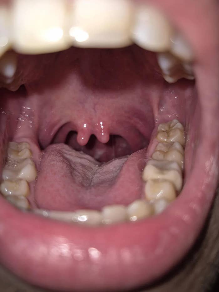 Close-up of an unfastened  rima  showing teeth, tongue, and uvula