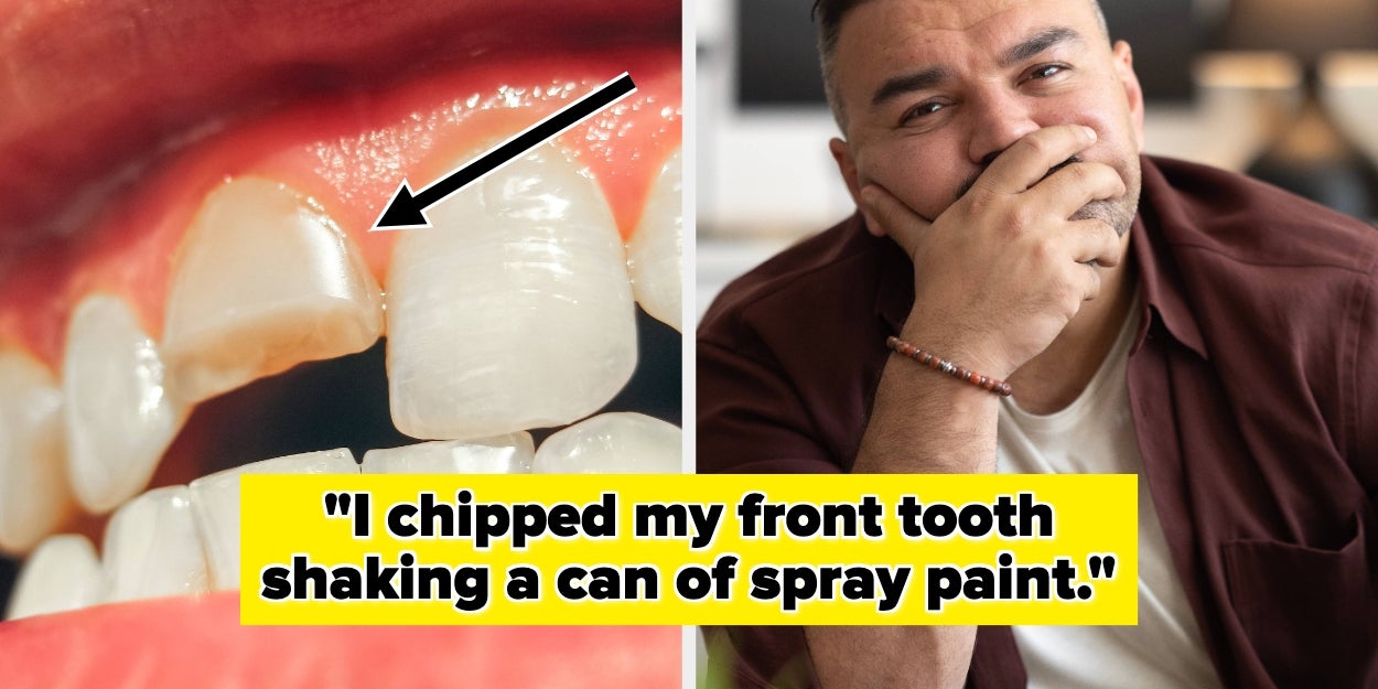 Ridiculous Ways People Accidentally Hurt Themselves