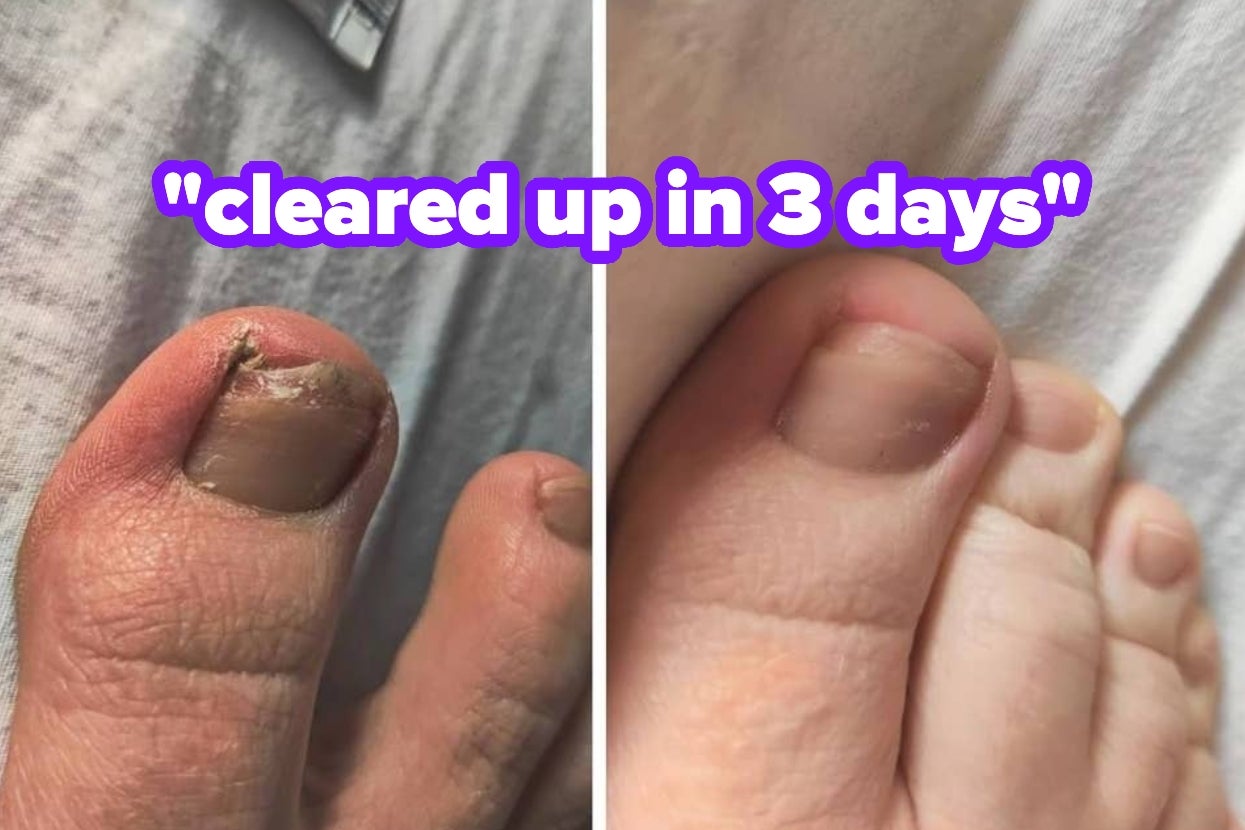 33 Products With Such Great Results, They’ll Make You Say “Oooh, I *Need* This”