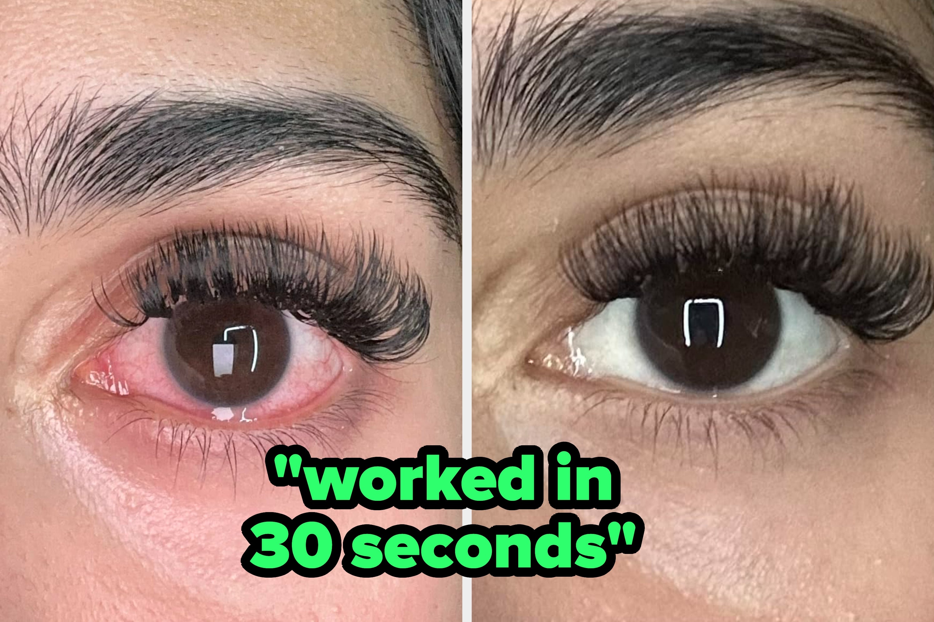 39 Products That'll Work Like A Charm For Those Persistent Body Problems You Can’t Stand