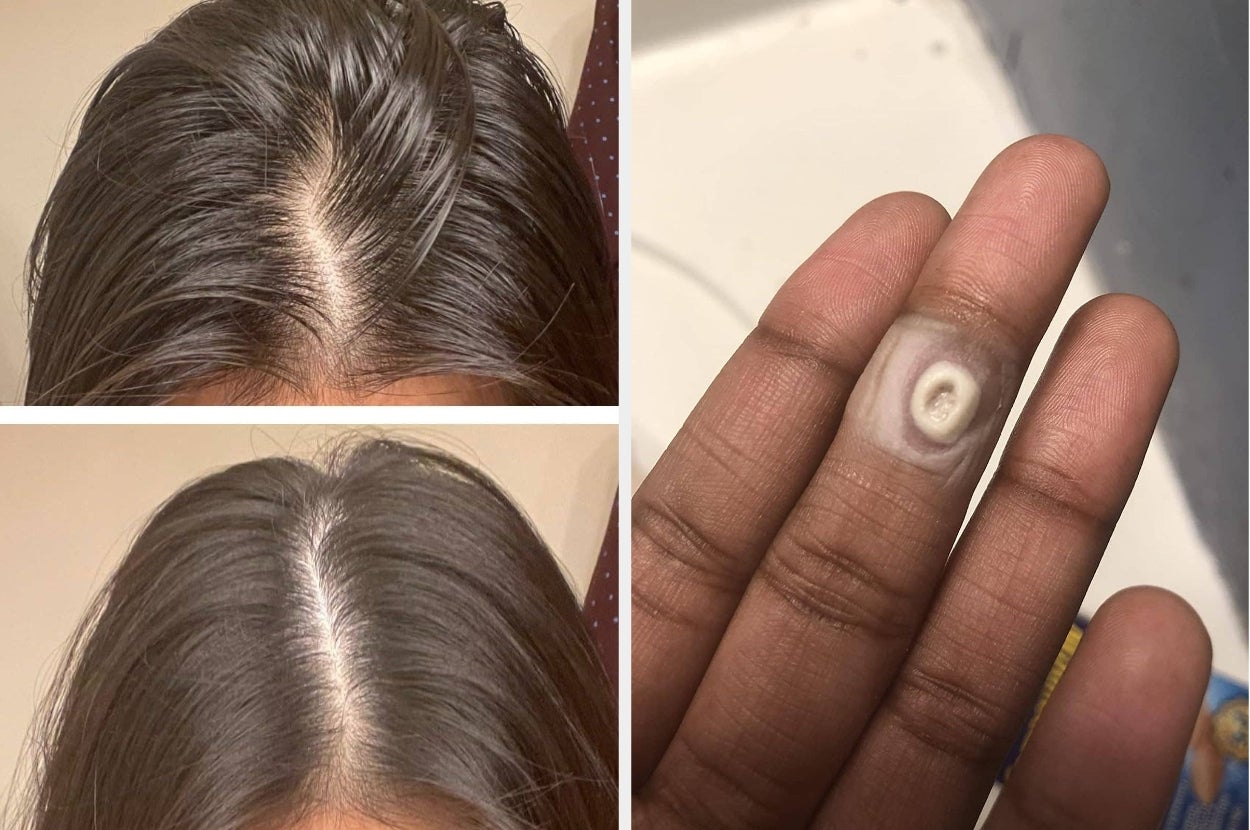 buzzfeed.com - Lily Burrill - Here Are The 29 Things To Deal With The Body Issues You'd Rather Not Broadcast To The World