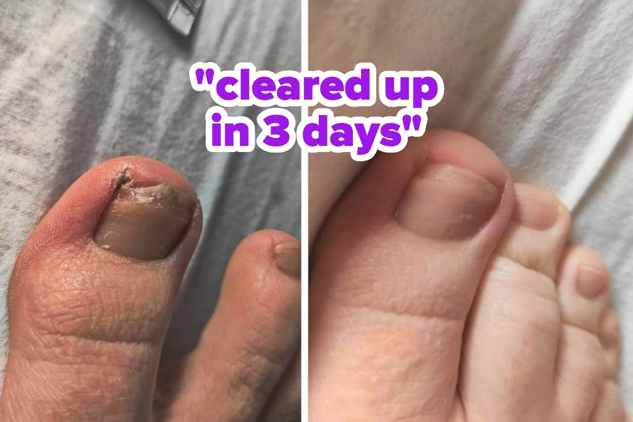 You'll Be Relieved To Know That These 44 Things Can Help With Some Your Body-Related Problems