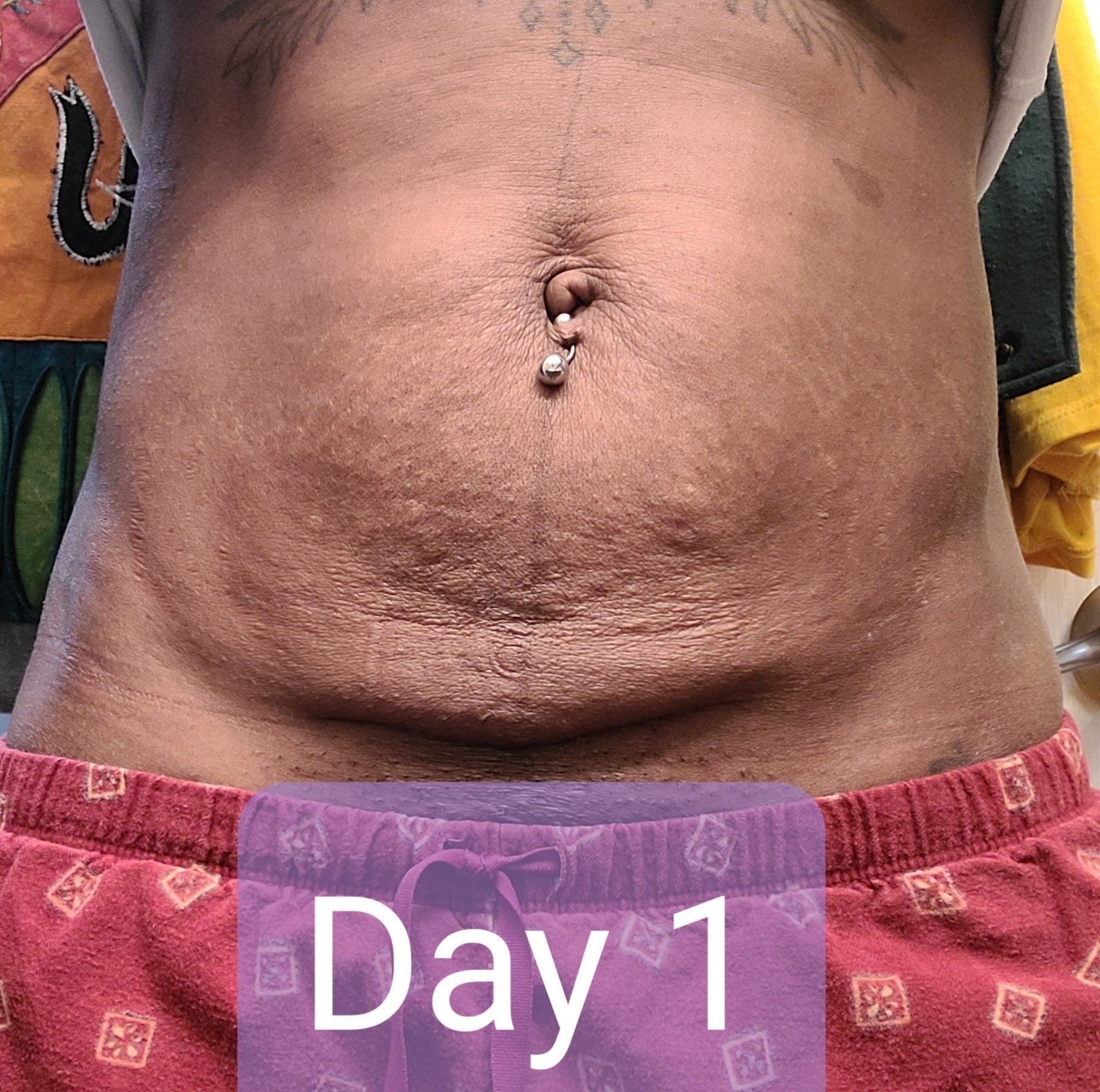 Close-up of a person’s abdomen showing skin texture with a belly button piercing. Bottom text reads 