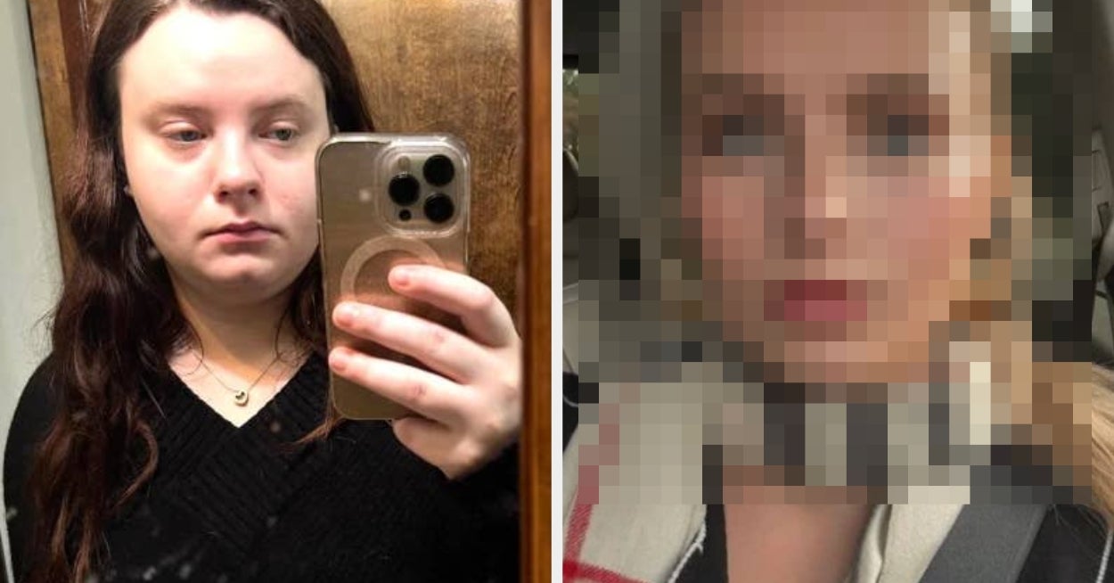 "I'm Peaking On An Edible, And I'm So Happy For You": People Are Freaking Out Over This 27-Year-Old Woman's "Non-Surgical" Facial Transformation