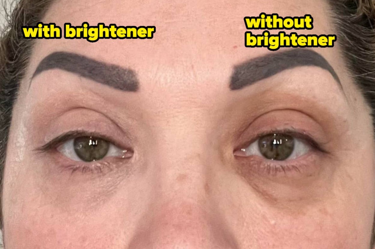 32 Products With Result Photos That Are Downright Shocking