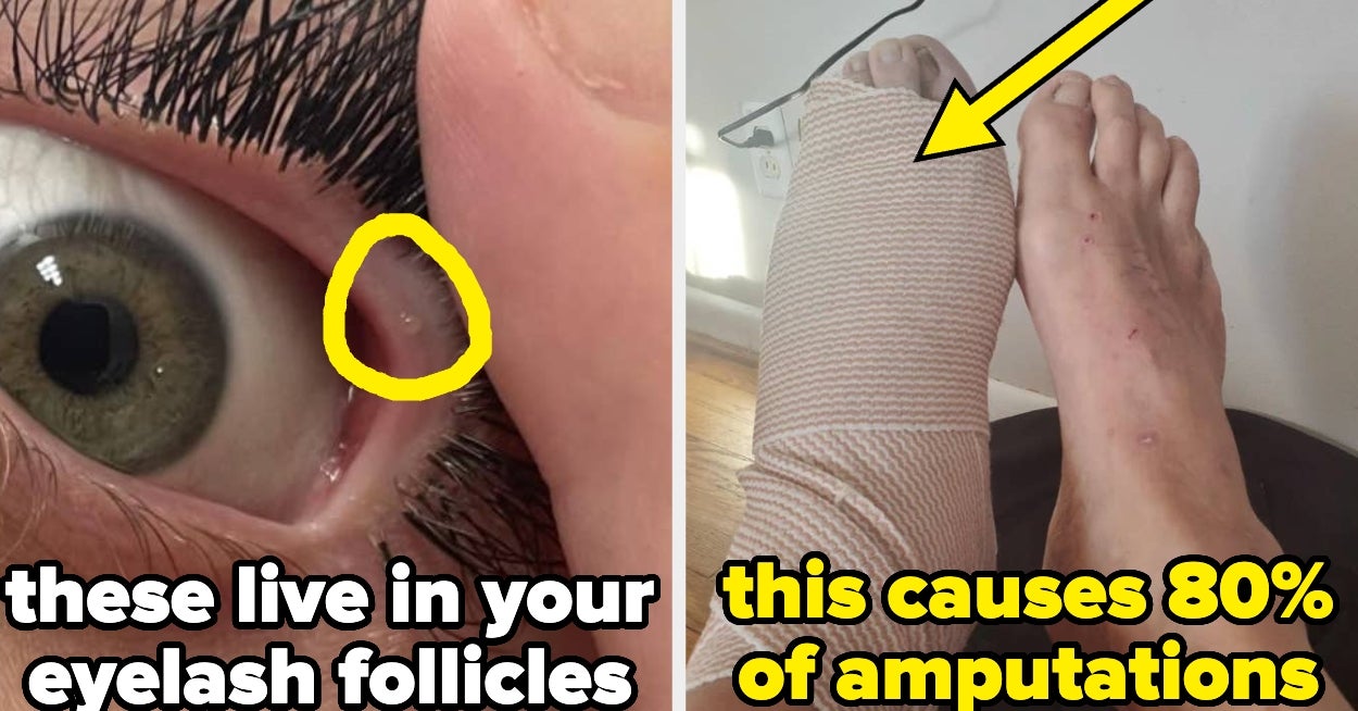 24 Disturbing Medical Facts That I Probably Didn't Need To Know, But Am Fascinated By Anyway