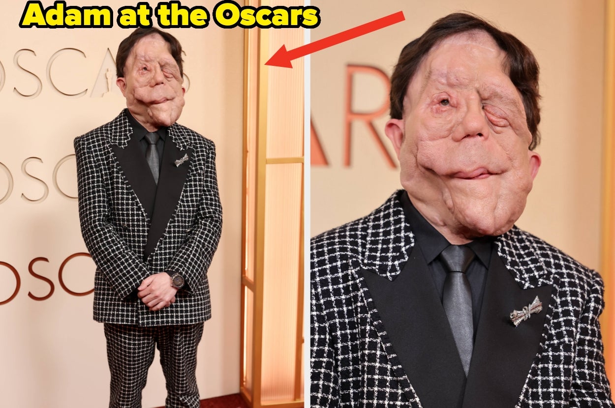 After A Comedian Made Fun Of His Appearance At The Oscars, Adam Pearson Responded Perfectly