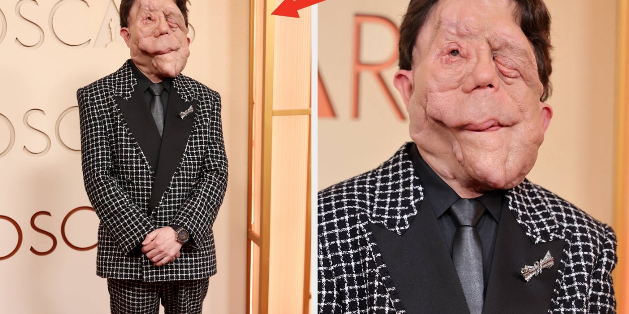 Adam Pearson Reacts To Joke About Oscars Appearance