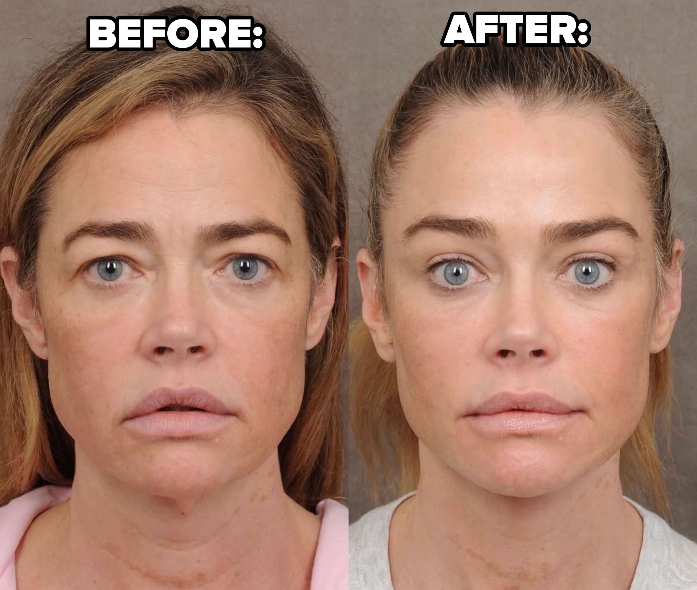Denise Richards with minimal constitution successful antithetic angles and lighting