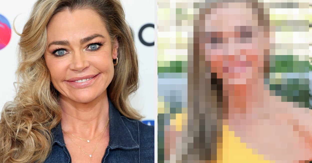 Denise Richards Just Debuted Her Facelift, And The Results Are Turning Heads