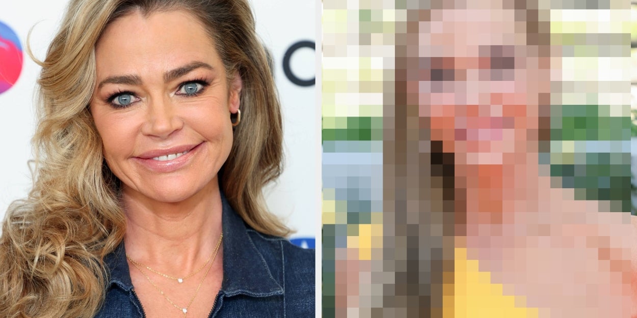 Denise Richard Posts Facelift Results