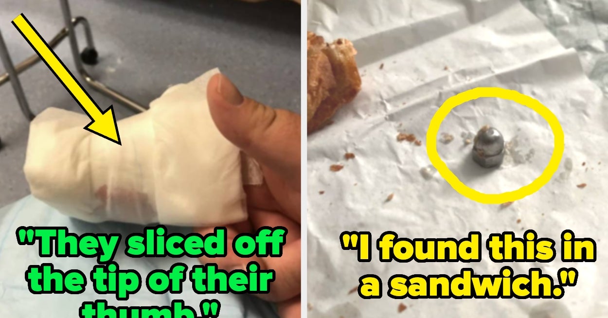 "The Tip Of His Pinky Was Never Found": 21 Gruesome, Horrifying, Or Just Straight-Up Dumb Things People Who Work In Kitchens Have Done (And Most Likely Regret)