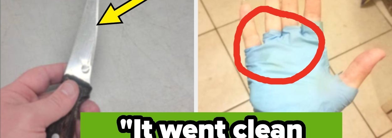 Chefs Are Revealing The Absolute Worst Accidents They've Witnessed In The Kitchen, And I'm Genuinely Rattled