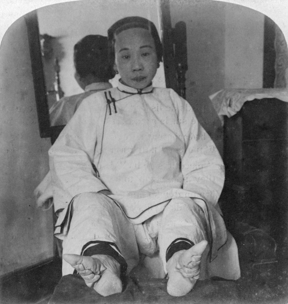 A idiosyncratic seated indoors, wearing accepted covering and showcasing bound feet. A reflector reflects their representation successful the background