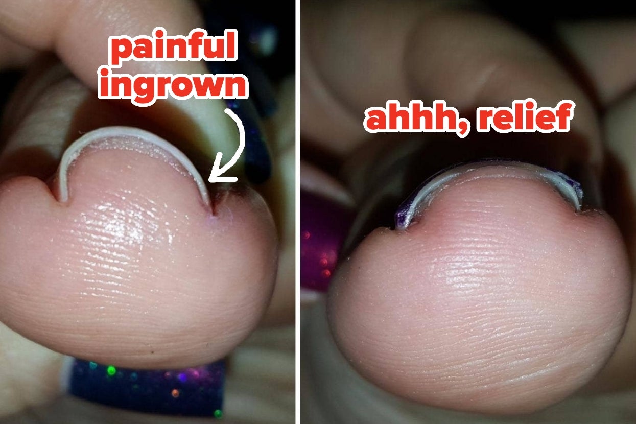 37 Game-Changing Personal Care Products For All Sorts Of Perplexing Problems